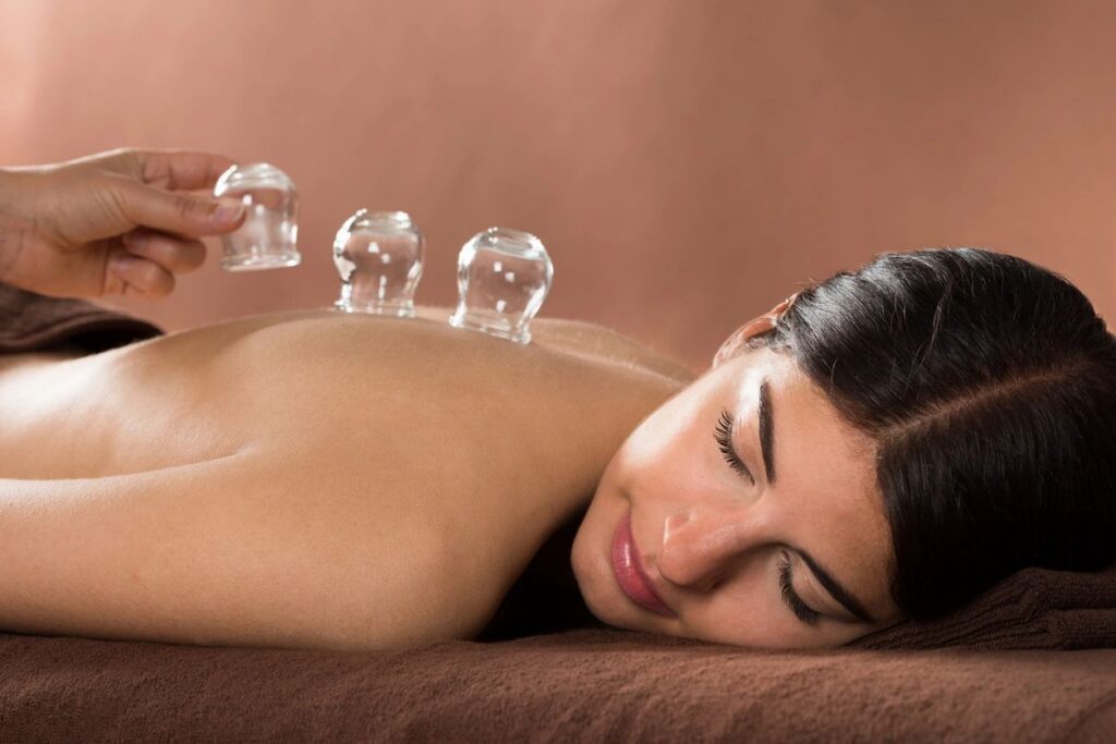 Woman receiving cupping therapy on back.