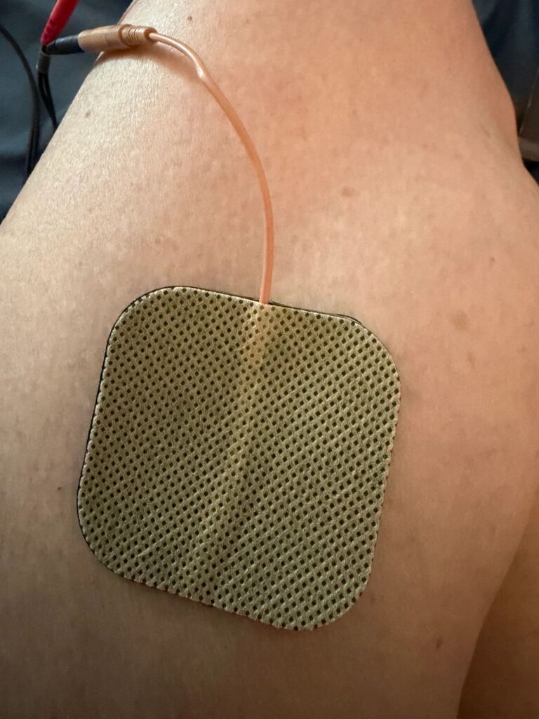 Electrode pad attached to a person's skin.