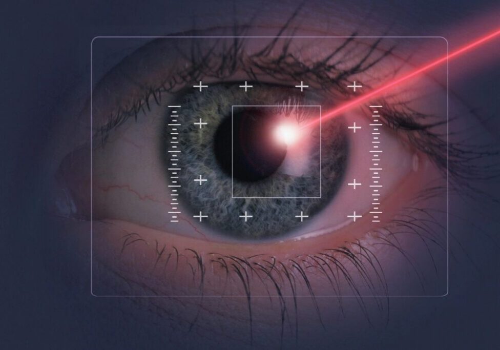 Eye undergoing laser vision correction surgery.
