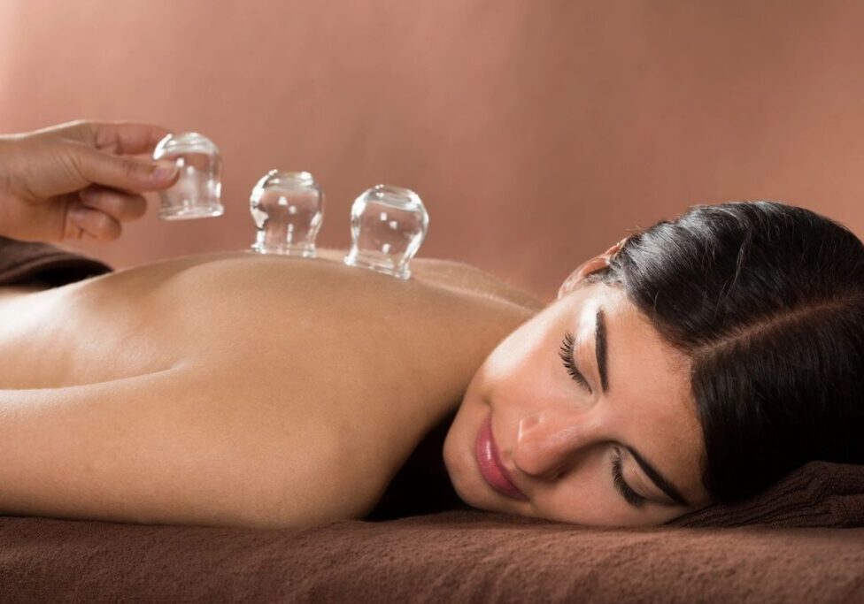 Woman receiving cupping therapy on back.